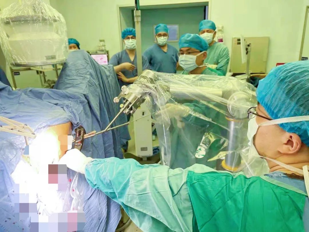 世界首例单切口经脐三角腹腔镜马蹄肾切除术在陕实施-中国科技网